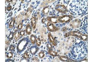 PKLR antibody was used for immunohistochemistry at a concentration of 4-8 ug/ml. (PKLR antibody  (N-Term))