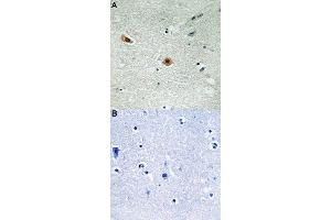 Immunohistochemical staining of human brain tissue by RB1 (phospho S608) polyclonal antibody  without blocking peptide (A) or preincubated with blocking peptide (B) under 1:50-1:100 dilution. (Retinoblastoma 1 antibody  (pSer608))