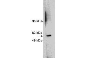 Western blot using  X1879P, rabbit polyclonal at 1 ug/ml on HeLa cell extract (20 ug/lane). (HDAC1 antibody)