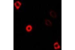 Immunofluorescent analysis of KIF3A staining in U2OS cells. (KIF3A antibody)