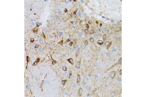 Immunohistochemistry of paraffin-embedded mouse brain using PGRMC1 antibody.