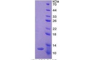 SDS-PAGE of Protein Standard from the Kit (Highly purified E. (Ghrelin ELISA Kit)