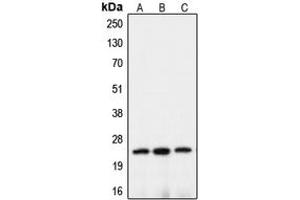 Western blot analysis of Claudin 10 expression in HEK293T (A), mouse brain (B), rat kidney (C) whole cell lysates.