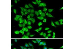 Immunofluorescence analysis of HeLa cells using NFATC3 Polyclonal Antibody (NFATC3 antibody)