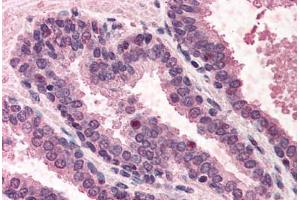 Human Prostate (formalin-fixed, paraffin-embedded) stained with POLK antibody ABIN291099 at 5 ug/ml followed by biotinylated anti-goat IgG secondary antibody ABIN481715, alkaline phosphatase-streptavidin and chromogen. (POLK antibody  (AA 817-830))