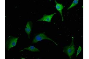 Immunofluorescence staining of U251 cells with ABIN7145119 at 1:50, counter-stained with DAPI.