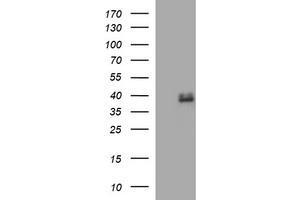 Image no. 1 for anti-Fatty Acid 2-Hydroxylase (FA2H) antibody (ABIN1500829) (FA2H antibody)