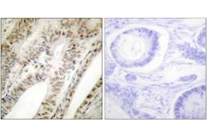 Immunohistochemistry analysis of paraffin-embedded human tonsil tissue, using PML Antibody. (PML antibody  (AA 11-60))