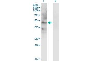 Western Blot analysis of LAMP2 expression in transfected 293T cell line by LAMP2 monoclonal antibody (M01), clone 2G10. (LAMP2 antibody  (AA 30-127))