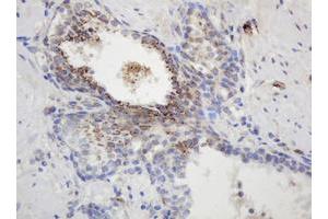 Image no. 2 for anti-Glyceraldehyde-3-Phosphate Dehydrogenase, Spermatogenic (GAPDHS) antibody (ABIN1498375) (GAPDHS antibody)