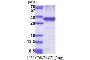 SDS-PAGE (SDS) image for Cathepsin Z (CTSZ) (AA 62-303) protein (His tag) (ABIN5853241)
