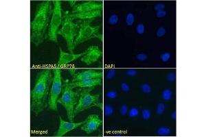 IF/ICC testing of fixed and permeabilized human HeLa cells with GRP78 antibody (green) at 5ug/ml and DAPI nuclear stain (blue). (GRP78 antibody)