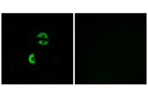 Immunofluorescence analysis of A549 cells, using LDLRAD3 antibody. (LDLRAD3 antibody  (Internal Region))