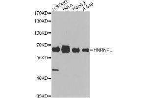 Western blot analysis of extracts of various cell lines, using HNRNPL antibody (ABIN5974591) at 1/1000 dilution. (HNRNPL antibody)