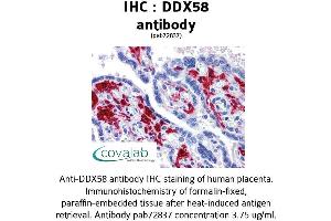 Image no. 2 for anti-DEAD (Asp-Glu-Ala-Asp) Box Polypeptide 58 (DDX58) antibody (ABIN1733572) (DDX58 antibody)