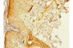 Immunohistochemistry of paraffin-embedded human skin tissue using ABIN7175005 at dilution of 1:100 (MRPL46 antibody  (AA 28-153))