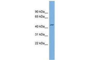 Image no. 1 for anti-Vesicle Amine Transport 1 (VAT1) (AA 71-120) antibody (ABIN6744944) (VAT1 antibody  (AA 71-120))