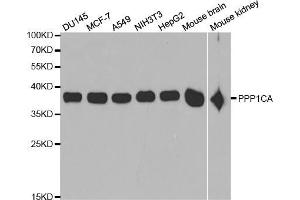 Western blot analysis of extracts of various cell lines, using PPP1CA antibody (ABIN5971210) at 1/1000 dilution.