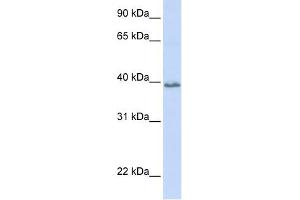 Tetraspanin 10 antibody used at 1 ug/ml to detect target protein. (TSPAN10 antibody  (N-Term))