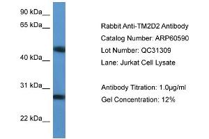WB Suggested Anti-TM2D2  Antibody Titration: 0. (TM2D2 antibody  (Middle Region))