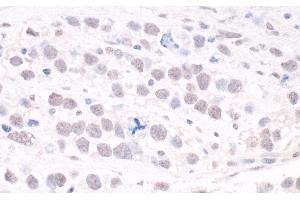 anti-AT Rich Interactive Domain 2 (ARID, RFX-Like) (ARID2) (AA 1785-1835) antibody