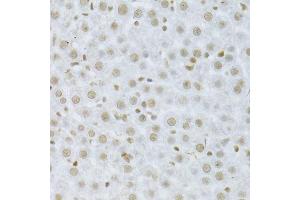 Immunohistochemistry (Paraffin-embedded Sections) (IHC (p)) image for anti-Mitogen-Activated Protein Kinase 3 (MAPK3) (AA 1-100) antibody (ABIN3020725)