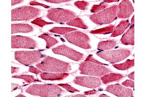 Anti-PYGM / Phosphorylase b antibody IHC of human skeletal muscle. (PYGM antibody  (Internal Region))
