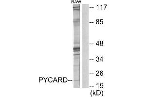 Western blot analysis of extracts from RAW264. (STS antibody  (N-Term))