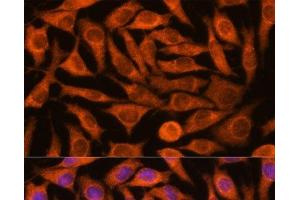 Immunofluorescence analysis of L929 cells using NDUFAF4 Polyclonal Antibody at dilution of 1:100. (NDUFAF4 antibody)