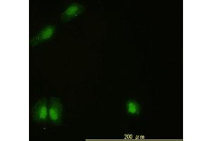 Immunofluorescence of monoclonal antibody to CAMK4 on HeLa cell. (CAMK4 antibody  (AA 1-473))