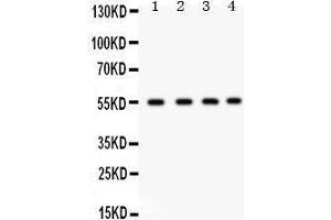 Western Blotting (WB) image for anti-Gap Junction Protein, alpha 3, 46kDa (GJA3) (AA 89-118), (N-Term) antibody (ABIN3042423) (GJA3 antibody  (N-Term))
