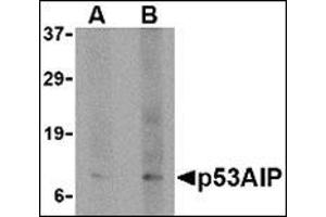 Western blot analysis of p53AIP1 in HL60 cell lysate with this product at (A) 4 and (B) 8 μg/ml. (TP53AIP1 antibody  (N-Term))