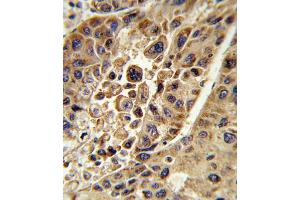 Immunohistochemistry (IHC) image for anti-Kynurenine 3-Monooxygenase (Kynurenine 3-Hydroxylase) (KMO) antibody (ABIN3003857) (KMO antibody)