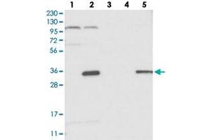 Western blot analysis of Lane 1: RT-4, Lane 2: U-251 MG, Lane 3: Human Plasma, Lane 4: Liver, Lane 5: Tonsil with C14orf94 polyclonal antibody .