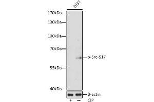 Western blot analysis of extracts of 293T cells, using Phospho-Src-S17 antibody  at 1:1000 dilution. (Src antibody  (pSer17))