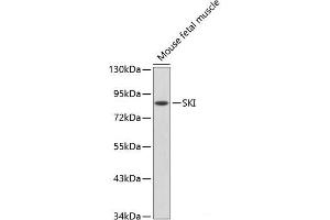 Western blot analysis of extracts of Mouse fetal muscle using SKI Polyclonal Antibody. (SKI antibody)