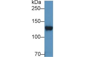 Western Blot; Sample: Rat Cerebrum lysate; Primary Ab: 2µg/ml Rabbit Anti-Human DPP6 Antibody Second Ab: 0. (DPP6 antibody  (AA 667-865))