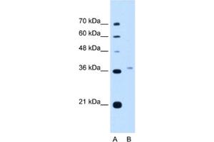 Western Blotting (WB) image for anti-Peroxisomal Biogenesis Factor 3 (PEX3) antibody (ABIN2462935) (PEX3 antibody)