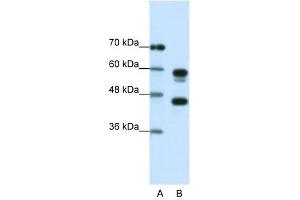 Western Blot showing PSMC5 antibody used at a concentration of 1-2 ug/ml to detect its target protein. (PSMC5 antibody  (C-Term))