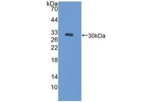 Detection of Recombinant PKD1, Human using Polyclonal Antibody to Protein Kinase D1 (PKD1) (PKC mu antibody)