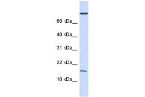 WB Suggested Anti-GABARAP Antibody Titration:  0.