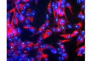 Human SH-SY5Y cells stained with mouse-anti-fibrillarin, showing prominent specular nucleolar staining. (Fibrillarin antibody)