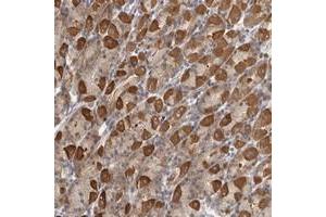 Immunohistochemical staining of human stomach with PARP6 polyclonal antibody  shows strong cytoplasmic positivity in Parietal cells at 1:50-1:200 dilution. (PARP6 antibody)