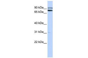 TRIM67 antibody used at 1 ug/ml to detect target protein. (TRIM67 antibody  (C-Term))