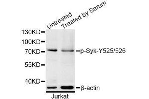 Western blot analysis of extracts of Jurkat cells, using Phospho-Syk-Y525/526 antibody (ABIN5996170) at 1/1000 dilution. (SYK antibody  (pTyr525, pTyr526))