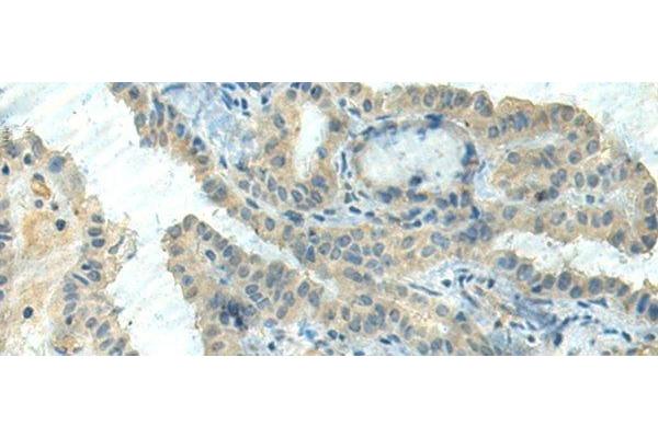 CTDP1 antibody