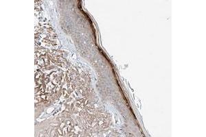 Immunohistochemical staining of human skin with TSR2 polyclonal antibody  shows strong positivity in superficial layers. (TSR2 antibody)