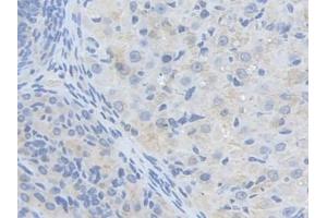 DAB staining on IHC-P; Samples: Mouse Ovary Tissue (ALDH9A1 antibody  (AA 322-494))
