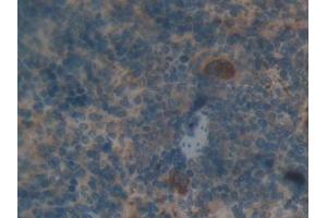 IHC-P analysis of Rat Spleen Tissue, with DAB staining. (Thrombospondin 1 antibody  (AA 71-259))