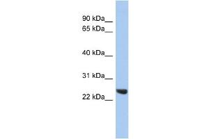 WB Suggested Anti-PSMB2 Antibody Titration: 0. (PSMB2 antibody  (Middle Region))